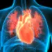 ARPA-H to invest $62M to build agentic AI agent for heart care